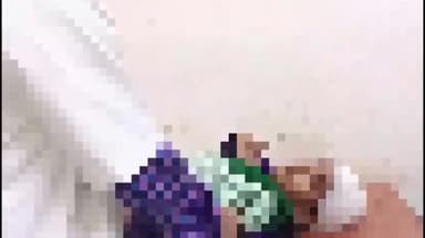 तोपचांची: भुइयां चितरो के उत्क्रमित उर्दू मध्य विद्यालय का छज्जा गिरने से दो छात्रा हुई गंभीर रूप से घायल