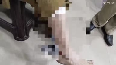 अम्बाला: सेक्टर-7 में आवारा कुत्तों ने बुजुर्ग महिला पर किया हमला, इलाज के लिए पहुंची शहर के सिविल अस्पताल