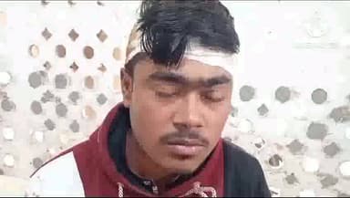 गोगरी: उत्क्रमित माध्यमिक विद्यालय राटन में खेलने को लेकर छात्रों के दो गुटों में मारपीट, एक छात्र घायल