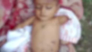 हुज़ूर: भोपाल के अयोध्या कुत्तों के काटने से हुई मौत में बच्चे का शव शमशान से निकाल पीएम के लिए भेजा।