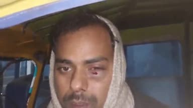 समस्तीपुर: रेलवे जंक्शन समस्तीपुर के गेट नंबर 1 पर सवारी बैठाने को लेकर हुए विवाद में एक टेम्पो चालक को मारपीट कर किया गया घायल