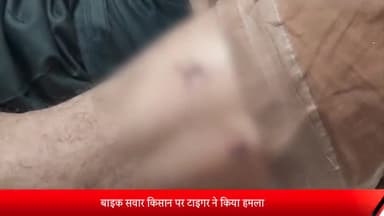 पीलीभीत: धनाराघाट शारदा नदी के पास में टाइगर ने बाइक सवार किसान पर किया हमला किसान को अस्पताल में कराया भर्ती
