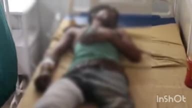 कुरवाई: मेहलुआ चौराहे के समीप लकड़ी काटते समय पेड़ से गिरने से युवक हुआ घायल, अस्पताल में उपचार जारी