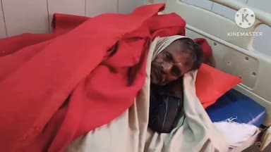 मौदहा: नरायच के ईंट भट्ठा में काम कर रहे दो दर्जन मजदूर मधु मक्खियों के हमले से हुए जख्मी