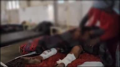 शिवपुरी नगर: पत्नी के साथ हुई छेड़छाड़ का विरोध करने पर पति-पत्नी को चार लोगों ने पीटा, जिला अस्पताल में भर्ती,वेदमऊ गांव की घटना