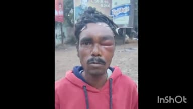 गुना: सिंघाड़ी गांव में शराब पीने रुपए न देने पर दो लोगों ने एक व्यक्ति से की मारपीट घायल ने एसपी से की शिकायत