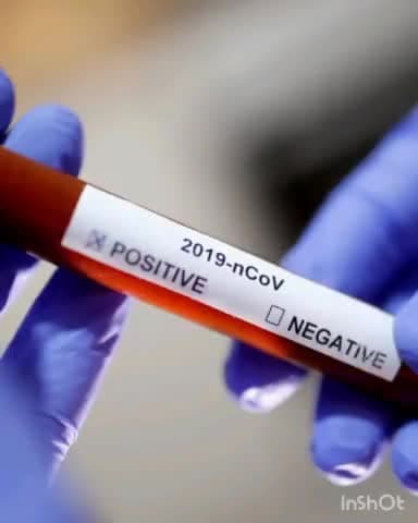 लकड़ी नबीगंज: लकड़ी नवीगंज सामुदायिक स्वास्थ्य केंद्र में कोविड -19 को मात्र देने के लिए कोविड -19 जांच हुआ शुरू