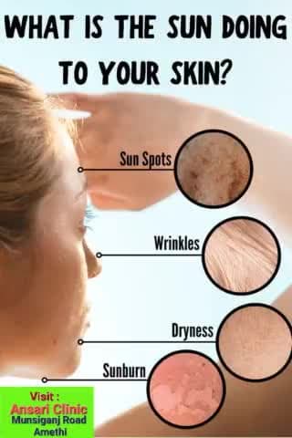 अमेठी शहर का पहला चर्मरोग क्लीनिक 
अंसारी क्लीनिक #skindoctor
#derma_consultant