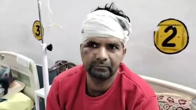 मुरादाबाद: मुगलपुरा थाना क्षेत्र में अवैध वसूली के पैसे देने का विरोध करने पर 4 लोगो ने एक व्यक्ति के साथ की जमकर मारपीट