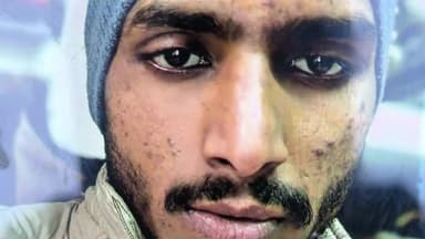 करनाल: अंजनथली कुटिया के पास अमीन के रहने वाले मुकेश की सड़क दुर्घटना में हुई मौत, करवाया गया पोस्टमार्टम