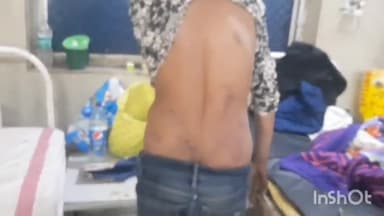 गुना नगर: नानाखेड़ी मंडी में नल जल योजना के पंप ऑपरेटर से की गई मारपीट, केस दर्ज