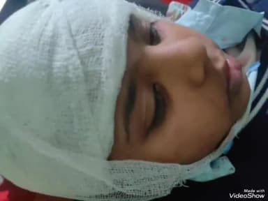 मिर्ज़ापुर: लालापुर में एमटीएस स्कूल की कक्षा एक की छात्रा को जर्मन शेफर्ड प्रजाति के पालतू कुत्ते ने काटकर किया जख्मी, मुकदमा दर्ज