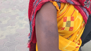 सिंगरौली: पीड़िता ने परिवार के अन्य सदस्यों पर मारपीट करने का लगाया आरोप नहीं हुई न्यासंगत कार्रवाई, रौहाल निवासी महिला ने एसपी से लगाई गुहार