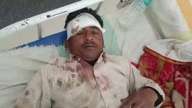 कहरा: जलई ओपी थाना के तेलवा गांव में बच्चे को लेकर हुए विवाद में मारपीट दो जख्मी सदर अस्पताल सहरसा में भर्ती