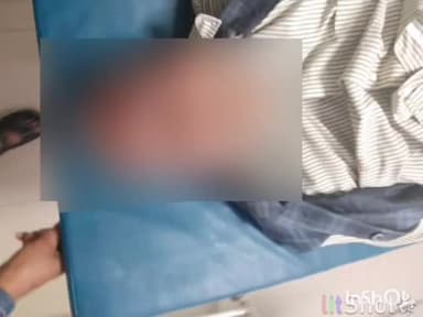 उरई: उरई के मोहल्ला गोपाल गंज इलाके से एक वृद्ध को लहूलुहान अवस्था में राजकीय मेडिकल कॉलेज में कराया गया भर्ती