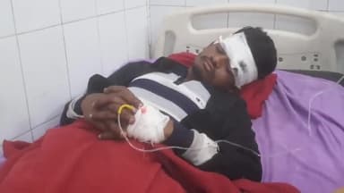 मिलक: दिल्ली-लखनऊ हाईवे 24 पर अज्ञात टेम्पो चालक ने बाइक सवार युवक को मारी टक्कर, बाइक सवार युवक हुआ घायल