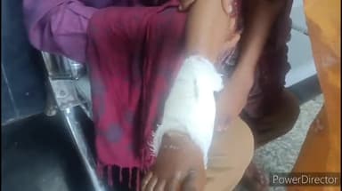 कहरा: बिहरा थाना क्षेत्र के बारा गांव में ई-रिक्शा से गिरकर बच्ची हुई जख्मी, सदर अस्पताल में भर्ती