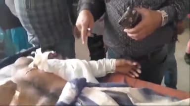 अररिया: बरर्डेगा गांव में चाकू मार कर एक व्यक्ति को किया घायल इलाज के लिए सदर अस्पताल में भर्ती