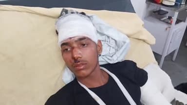 रामपुर: सिमरा मोड़ पर मारुति कार की टक्कर से मोटरसाइकिल सवार तीन लोग हुए घायल, जिला अस्पताल में उपचार जारी