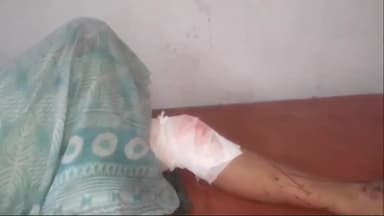 अररिया: बालू चौक के समीप ऑटो ने कार में मारी टक्कर हादसे में एक महिला घायल सदर अस्पताल में भर्ती