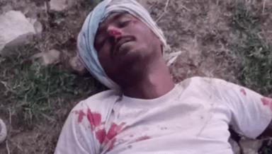 सिंगरौली: फुलकेश गांव के मोड़ पर 4 फीट हाइट तक उछली बेकाबू मोटरसाइकिल, चालक सहित तीन युवक गंभीर रूप से हुए घायल