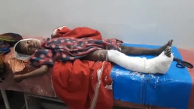 सासाराम: बड़की करपुरवा गांव में छत पर से गिरकर घायल हुआ एक 7 वर्षीय लड़का, इलाज के लिए लाया गया अस्पताल