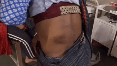 सिंगरौली: डकैती की नीयत से पीड़ित दम्पति के साथ हुई मारपीट, पीड़ित ने की जल्द से जल्द कार्रवाई की मांग