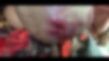 हमीरपुर: हमीरपुर मुख्यालय में किराया मांगा तो ईरिक्शा चालक को मारपीट कर किया लहुलुहान