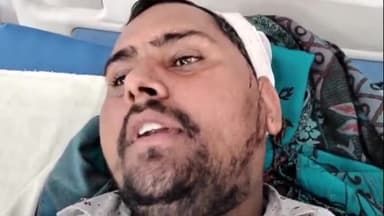 बिलारी: मैनाठेर क्षेत्र में तेज रफ्तार ट्रक ने बाइक में पीछे से मारी टक्कर, बाइक सवार इमरतपुर निवासी व्यक्ति गंभीर रूप से घायल