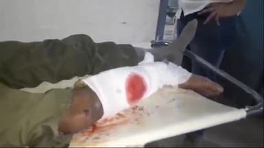 अररिया: गैयारी के पास बाइक और चार चक्का वाहन में हुई टक्कर में बाइक सवार एक व्यक्ति घायल सदर अस्पताल में भर्ती