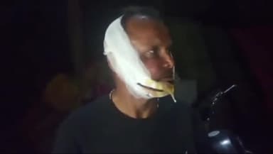 सुल्तानपुर: अधेड़ की पिटाई के मामले में गंभीर धाराओं में केस दर्ज, बंधुआकला के अलीगंज की है घटना