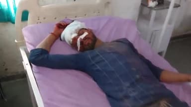 रामपुर: थाना भोट क्षेत्र के कोली कोला के पास मारुति कार की टक्कर से मोटरसाइकिल सवार 3 लोग हुए घायल, जिला अस्पताल में भर्ती