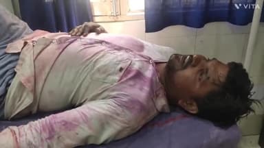 अम्बाला: न्यू रतनगढ़ में पारिवारिक झगड़े में मां बेटे पर चाचा के लड़के ने किया हमला गंभीर रूप से घायल लाया गया नागरिक अस्पताल