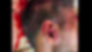 हमीरपुर: चंद्रपुरवा गेट के पास बाइक में कार ने मारी टक्कर, बाइक चालक हुआ गंभीर घायल