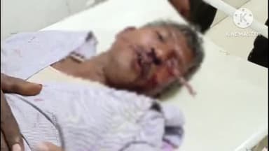 जहानाबाद: नोनही गांव के पास वाहन से चकमा खाकर एक व्यक्ति सड़क दुर्घटना के हुए शिकार,गंभीर स्थिति में सदर अस्पताल में हुए भर्ती