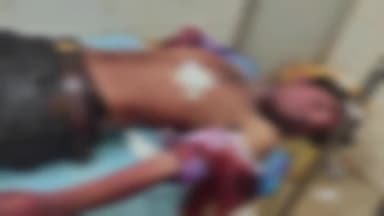 जयसिंहनगर: चंदेला रोड में स्थित बगार में दोस्त ने की दोस्त की हत्या, बीच बचाव में तीन दोस्त हुए घायल