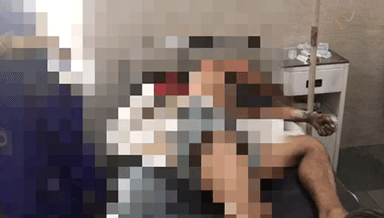 सिंगरौली: खेत में काम करने के दौरान करंट की चपेट में आया एक युवक गन्नई गांव की घटना जिला चिकित्सालय में युवक का चल रहा है इलाज