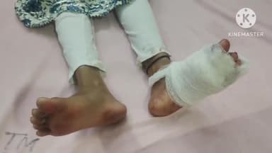 फिरोज़ाबाद: थाना दक्षिण क्षेत्र स्टेशन रोड पर ई-रिक्शा पलटने से सवार दो विवाहितायें घायल, कराया गया उपचार