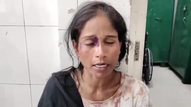 मुरादाबाद: मझोला थाना क्षेत्र में पति ने किसी दूसरी महिला के चक्कर में पत्नी से की जमकर मारपीट पत्नी हुई घायल