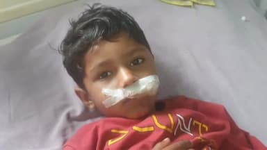 रामपुर: तिराहा गांव के समीप सड़क पार करते समय एक लड़के को बाइक सवार ने मारी टक्कर, घायल लड़के को जिला अस्पताल में कराया गया भर्ती