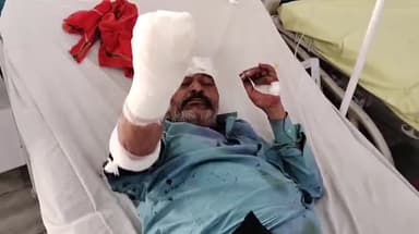 मुरादाबाद: मझोला थाना क्षेत्र में रेलवे ट्रैक पार करते समय मजदूर ट्रैन को चपेट मे आने से कटा एक हाथ हुआ घायल