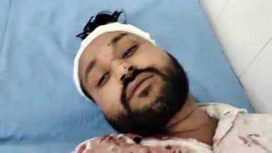 मुरादाबाद: मझोला थाना क्षेत्र में प्रॉपर्टी को लेकर पिता और बडे़ पुत्र ने मिलकर छोटे पुत्र को साथ की मारपीट छोटा पुत्र मारपीट घायल