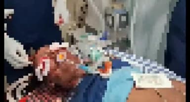 धनबाद/केंदुआडीह: धनबाद शहर के वासेपुर ओवर ब्रिज पर दो मोटरसाइकिल में टक्कर एक की हालत नाजुक