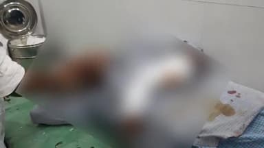 सासाराम: करपूरवा गांव में आपसी रंजिश को लेकर दो पक्षों में हुई मारपीट, एक व्यक्ति हुए घायल