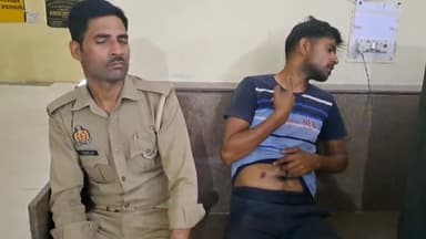 फिरोज़ाबाद: गांव बाजिदपुर के ठार इलाके में छोटे भाई ने बड़े भाई को मारपीट कर दांतों से काटा, खेत में पशु जाने के विरोध पर हुआ विवाद