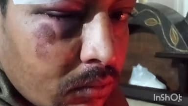 करनाल: शास्त्री नगर में एक युवक पर तेजधार हथियार से किया गया हमला, बीच-बचाव में मां और भाई भी घायल