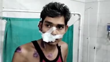 मुरादाबाद: मझोला थाना क्षेत्र में अचानक चलते-चलते ऑटो अनियंत्रित होकर पलटा, 2 बच्चे सहित 5 लोग हुए घायल