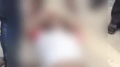 मलिहाबाद: दुबग्गा में भीषण सड़क हादसे में युवक गंभीर रूप से हुआ घायल