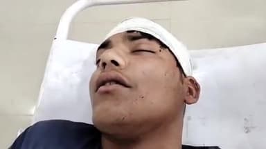 मुरादाबाद: कांठ थाना क्षेत्र में दो युवकों के साथ 4 से 5 लोगो ने मामूली बात पर की मारपीट दोनो हुए घायल