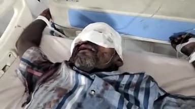 मुरादाबाद: कटघर थाना क्षेत्र में रेलवे ट्रैक पार करते समय मजदूर ट्रैन की चपेट में आकर हुआ गंभीर रूप से घायल इलाज के लिए भर्ती